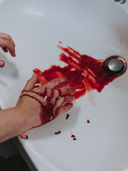 Aufnahme eines Waschbeckens mit einer Hand und Blut, welches auf der Hand und im Waschbecken zu sehen ist.