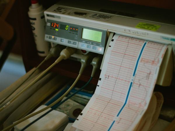 Aufnahme eines EKG-Geräts.