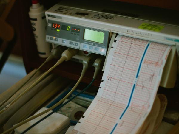 Shot of an ECG device.