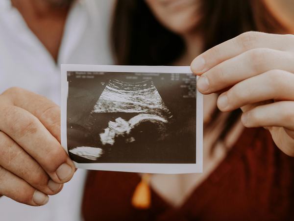 Detailaufnahme zweier Hände, welche ein Ultraschallbild mit dem Kopf eines Babys halten.